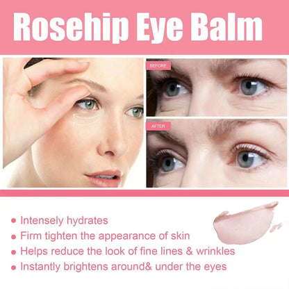 Women Extra Renewing Rosehip Eye Cream For Face Lifting Moisturizing Balm Stick Anti-Puffiness Remove Dark Circle Eye Care 2024